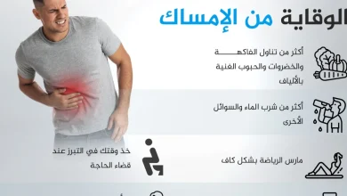 حالات الإمساك