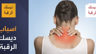 ديسك الرقبة