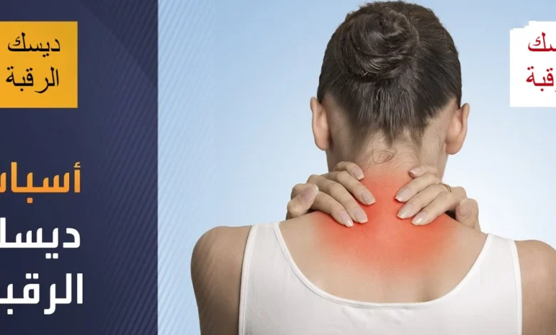 ديسك الرقبة