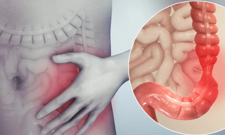 أمراض القولون العصبي وأعراضه وطرق علاجة