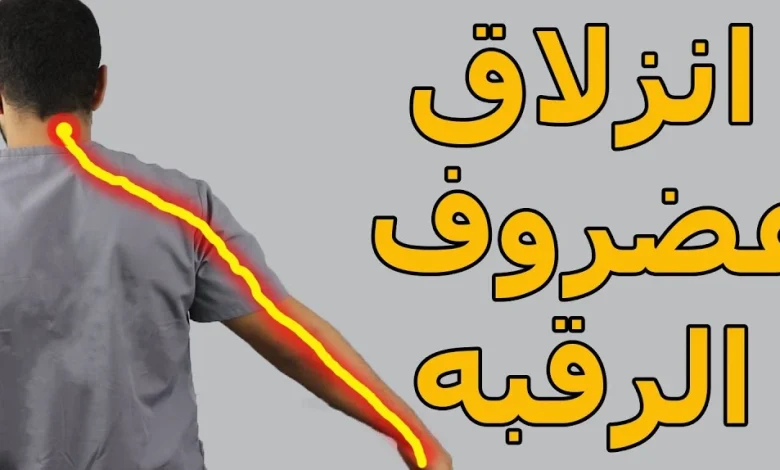 انزلاق غضروف الرقبة