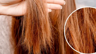 علاج تساقط الشعر