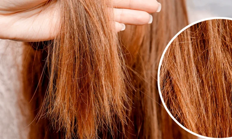 علاج تساقط الشعر