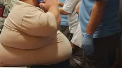 تشخيص السمنة