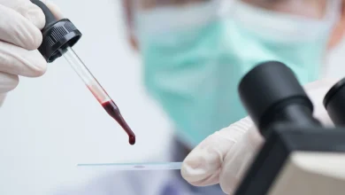 تشخيص وعلاج الملاريا وكيفية انتقال المرض