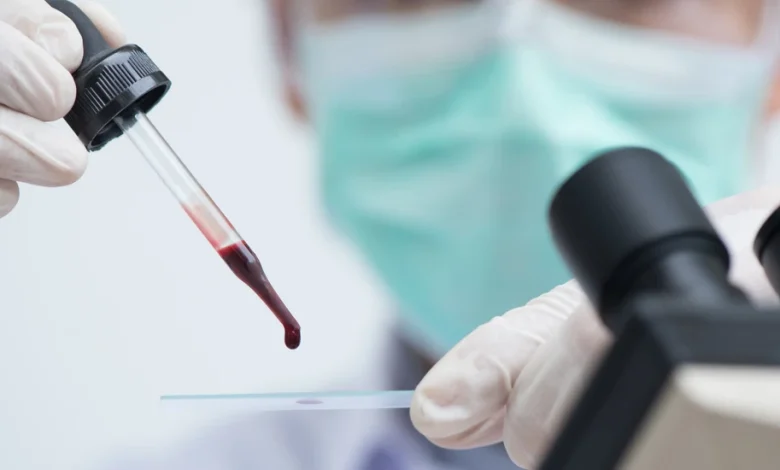 تشخيص وعلاج الملاريا وكيفية انتقال المرض