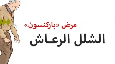 علاج شلل الرعاش (باركنسون) والوقاية منه