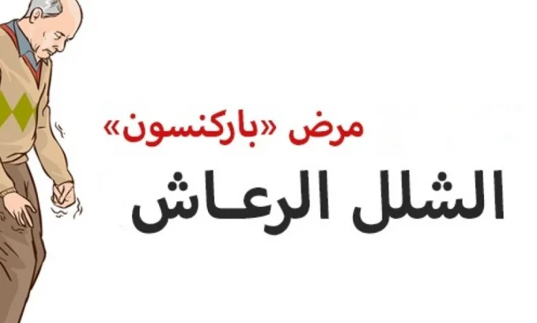 علاج شلل الرعاش (باركنسون) والوقاية منه