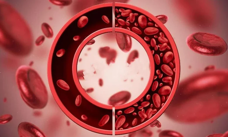 علاج فقر الدم