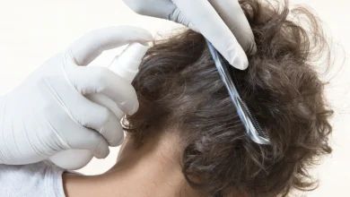 علاج القمل والصيبان في شعر الرأس والإبط