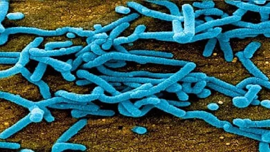 فيروس ماربورغ