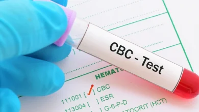 تحليل الدم الشامل 10 نصائح هامة قبل إجرائه