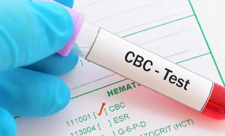تحليل الدم الشامل 10 نصائح هامة قبل إجرائه
