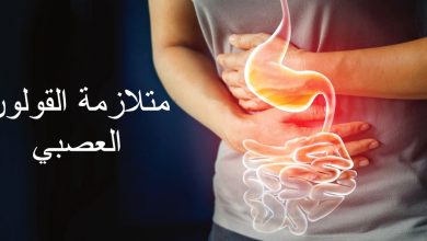 متلازمة القولون العصبي