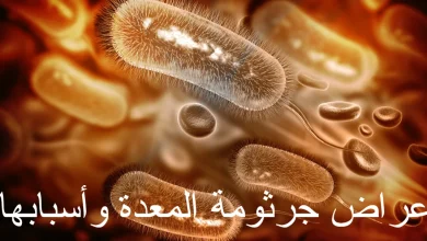 أعراض جرثومة المعدة وأسبابها