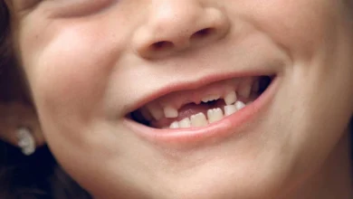 6 أسباب لتساقط الأسنان وكيفية الحفاظ عليها