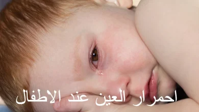 احمرار العين عند الأطفال و 9 طرق للوقاية