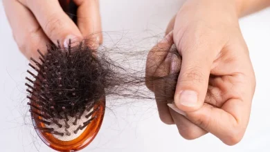 تساقط الشعر عند النساء