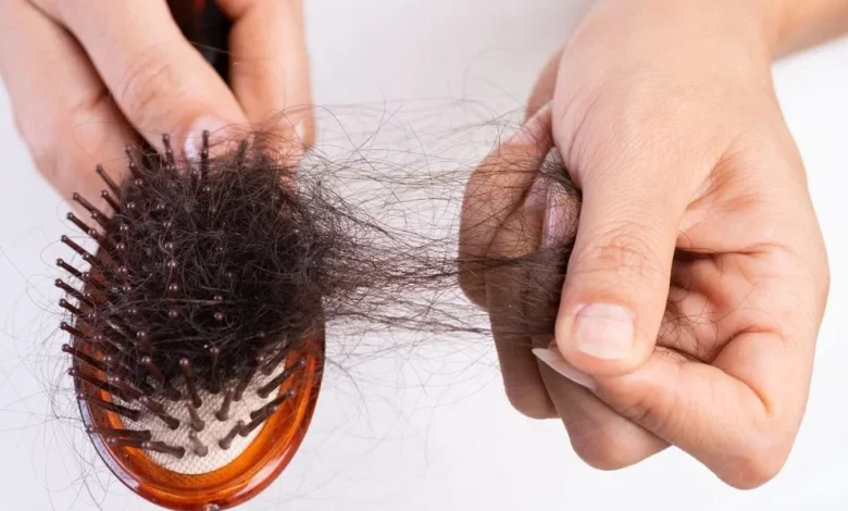 تساقط الشعر عند النساء
