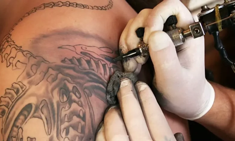 طرق إزالة الوشم