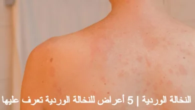 النخالة الوردية