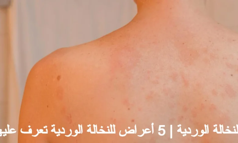 النخالة الوردية