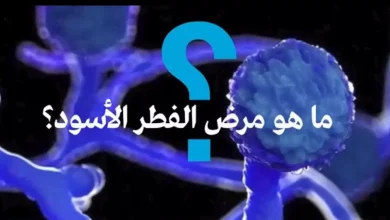 مرض الفطر الأسود