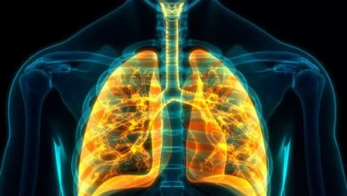 إلتهاب القصبات الحاد