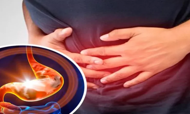 أمراض المعدة