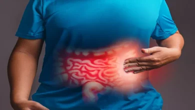 مرض القولون العصبي