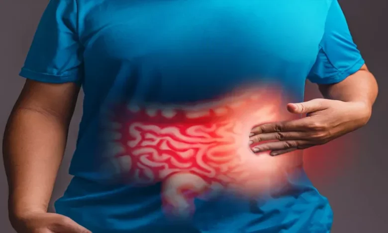 مرض القولون العصبي