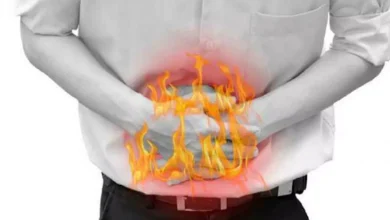 حموضة المعدة