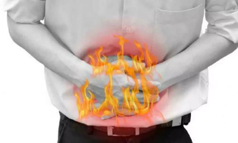 حموضة المعدة