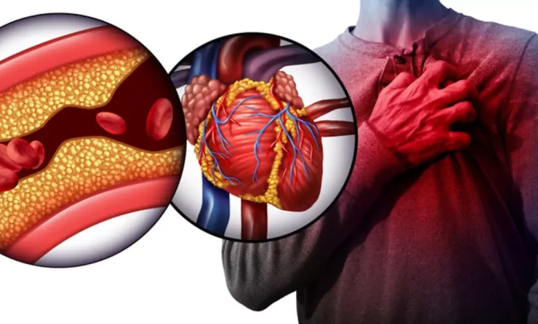 مستويات الكولسترول