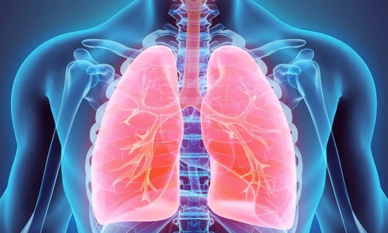مرض إنتفاخ الرئة