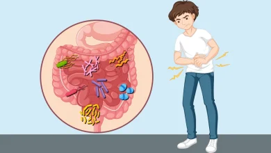 مرض التسمم الغذائي