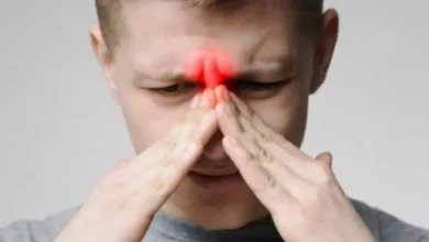 إلتهاب الجيوب الأنفية