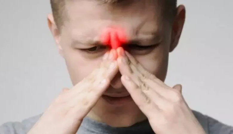 إلتهاب الجيوب الأنفية