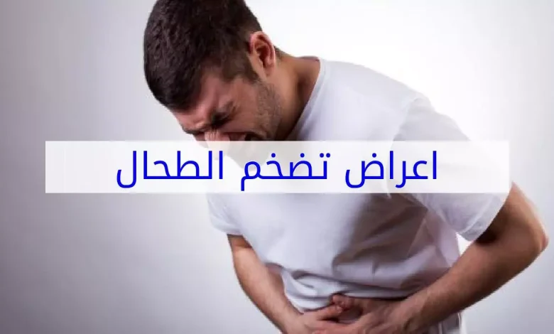 تضخم الطحال