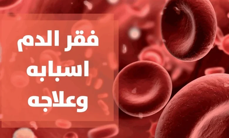 مرض فقر الدم