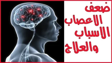 مرض ضعف الأعصاب