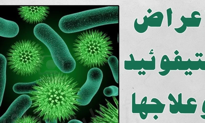 مرض حمى التيفوئيد