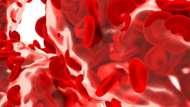 مرض فقر الدم الإنحلالي