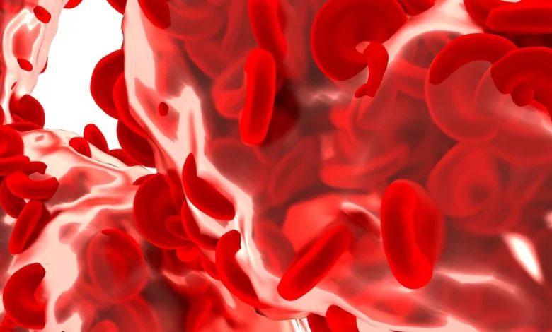 مرض فقر الدم الإنحلالي