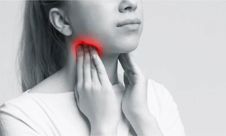 مرض إلتهاب الحنجرة