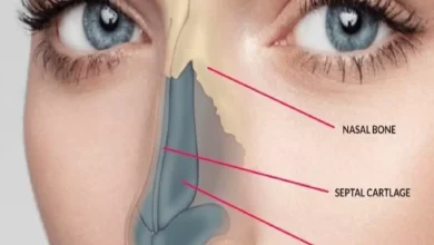 مرض الفطر الاسود أعراضه