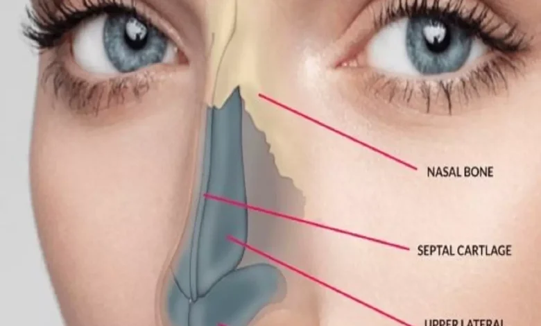 مرض الفطر الاسود أعراضه