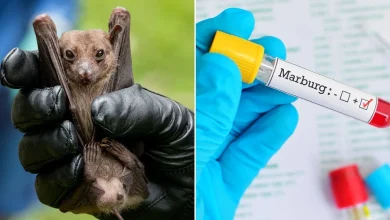 مرض فيروس ماربورغ