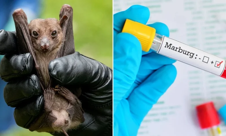 مرض فيروس ماربورغ