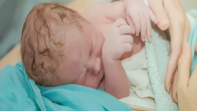 الولادة القيصرية الاسباب وعلاماتها ومخاطرها